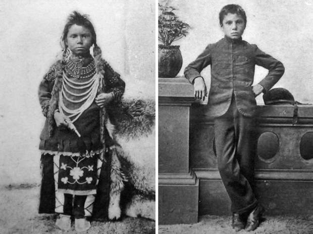 before and after indigineous child