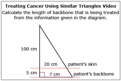 This is a diagram for the "Treating Cancer Using Similar Triangles" video.