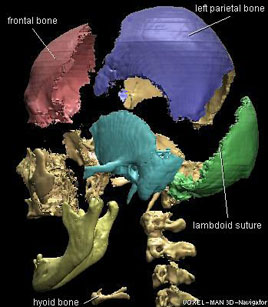 This is an image of a human skull in exploded view.