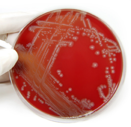 This is a photo of E. coli bacteria in a Petri dish.