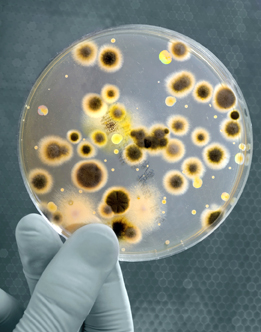 This photo shows bacteria growing in a Petri dish.
