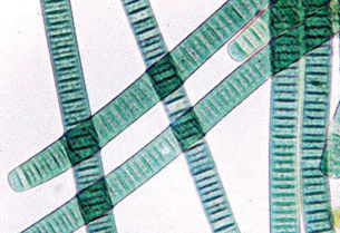 This photograph is a microscopic view of cyanobacteria. The cyanobacteria look like flattened, green, transparent worms.