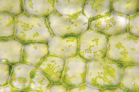 This magnification is of a cluster of plant cells. Several  green-coloured chloroplasts are present in each cell.