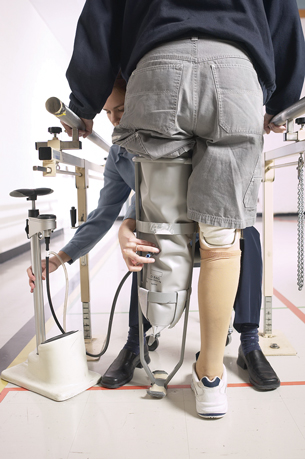 A person is being fitted for a prosthetic leg.