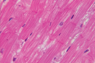 This is a magnified photo of skeletal muscle cells. The nuclei are stained purple, while the striations are stained a dark pink.