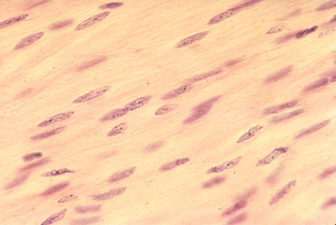 This magnified photo is of smooth muscle cells. The nuclei are stained purple. There are no striations.