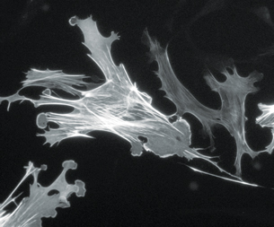 This is a micron photograph of stained actin filaments in a muscle cell. The filaments look like lines of white inside the cell.