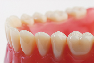 This photo is of a bottom set of dentures.