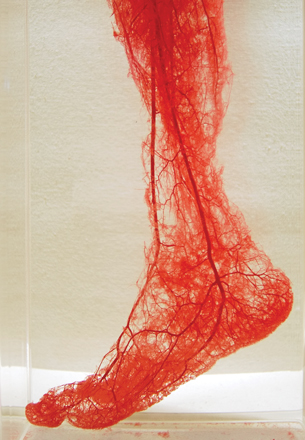 This photo shows the intricate network of blood vessels in the human foot.