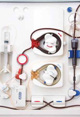 This photo is of an artificial kidney dialysis machine. Blood is transfused from a person’s arm via an intervenous tube and pumped through a machine with semipermiable membranes, which filters the blood. The blood returns to the person via another intervenous tube.