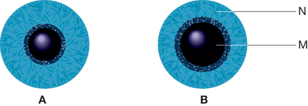 Two diagrams showing the iris in bright and dim light. The diagram on the left shows a constricted pupil, producing a small central dark area in the centre of the eye. The diagram on the right shows  a dilated pupil, producing a large central black area in the centre of the eye.  The central black area is labeled “M,” the surrounding blue area is labeled “N.”