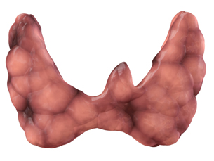 This image shows a thyroid gland.
