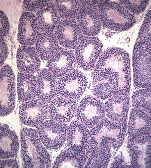 This image shows a cross-section of a seminiferous tubule at 100X magnification; developing sperm cells are stained purple.