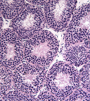 This image shows a cross-section of a seminiferous tubule at 200X magnification; developing sperm cells are stained purple.