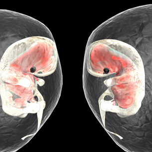 This image shows twin embryos developing in separate amniotic sacs.