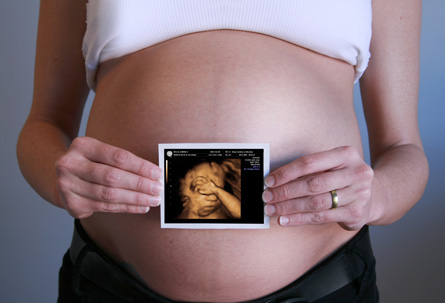 This photograph shows a pregnant mother holding an echogram image of her fetus in front of her bare belly.