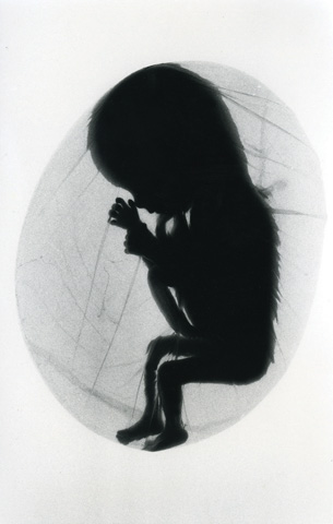 This illustration is of a silhouette of fetus, in uterus, full term fetus