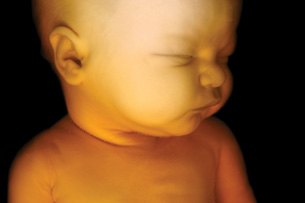 This image shows the head and shoulders of a fully developed fetus in utero.