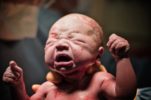 This photograph shows a newborn just seconds after delivery. It is being held upright by gloved hands.