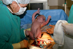 This photograph shows a baby being delivered by Caesarian section.