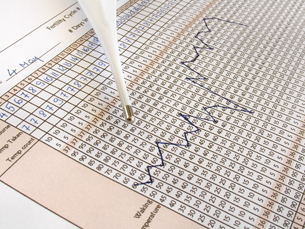 This photograph shows a fertility chart with temperature readings. A basal thermometer is lying on top of chart.
