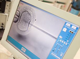 This photograph is of a computer monitor showing an intracytoplasmic sperm injection (ICSI).