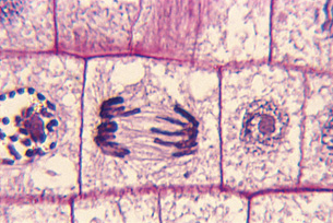 This image shows the separation of chromosomes in various stages of mitosis 