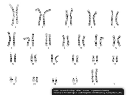 This photo of a female karyotype. It shows all the homologous chromosomes in pairs.