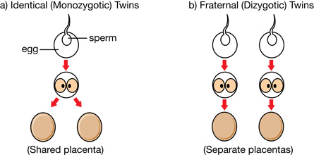 This image shows the union of one sperm and one egg for identical twins, and two separate sperm and egg fertilization events for fraternal twins.