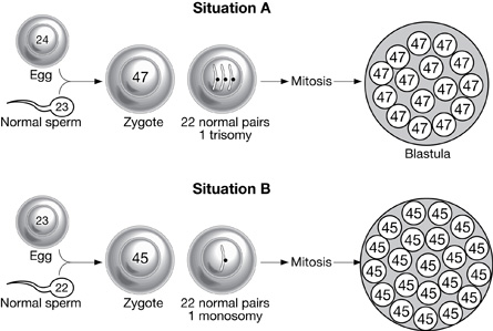 The diagram depicts Situation A, showing fertilization of one normal and one abnormal gamete.The diagram depicts Situation B, showing fertilization of one normal and one abnormal gamete.The diagram depicts Situation B, showing fertilization of one normal and one abnormal gamete. The diagram depicts Situation B, showing fertilization of one normal and one abnormal gamete.
