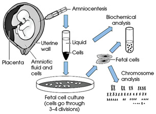 The flow chart illustrates the steps of amniocentesis.