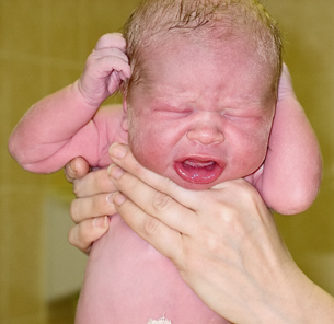 The photo shows a newborn human baby.