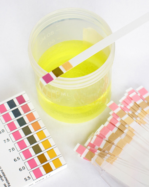 A photograph shows a yellow solution in a beaker. Around the beaker are many pH test strips and a colour-comparison chart.