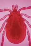 An electron micrograph photo of a deer tick shows the insect’s head, abdomen, and legs.