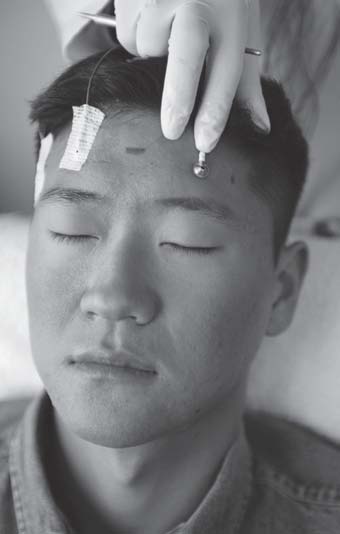 young man with electrode on his head