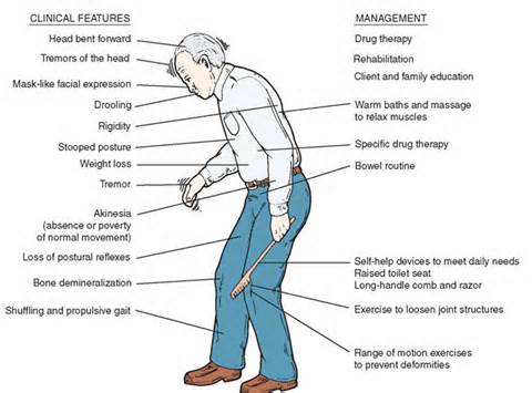 Parkinson`s symptoms