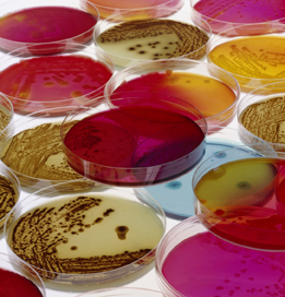 This is a photo of bacteria in Petri dishes.